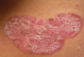 ���՗�ɭ����